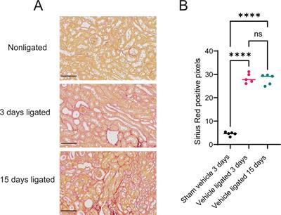 Targeting AXL cellular networks in kidney fibrosis